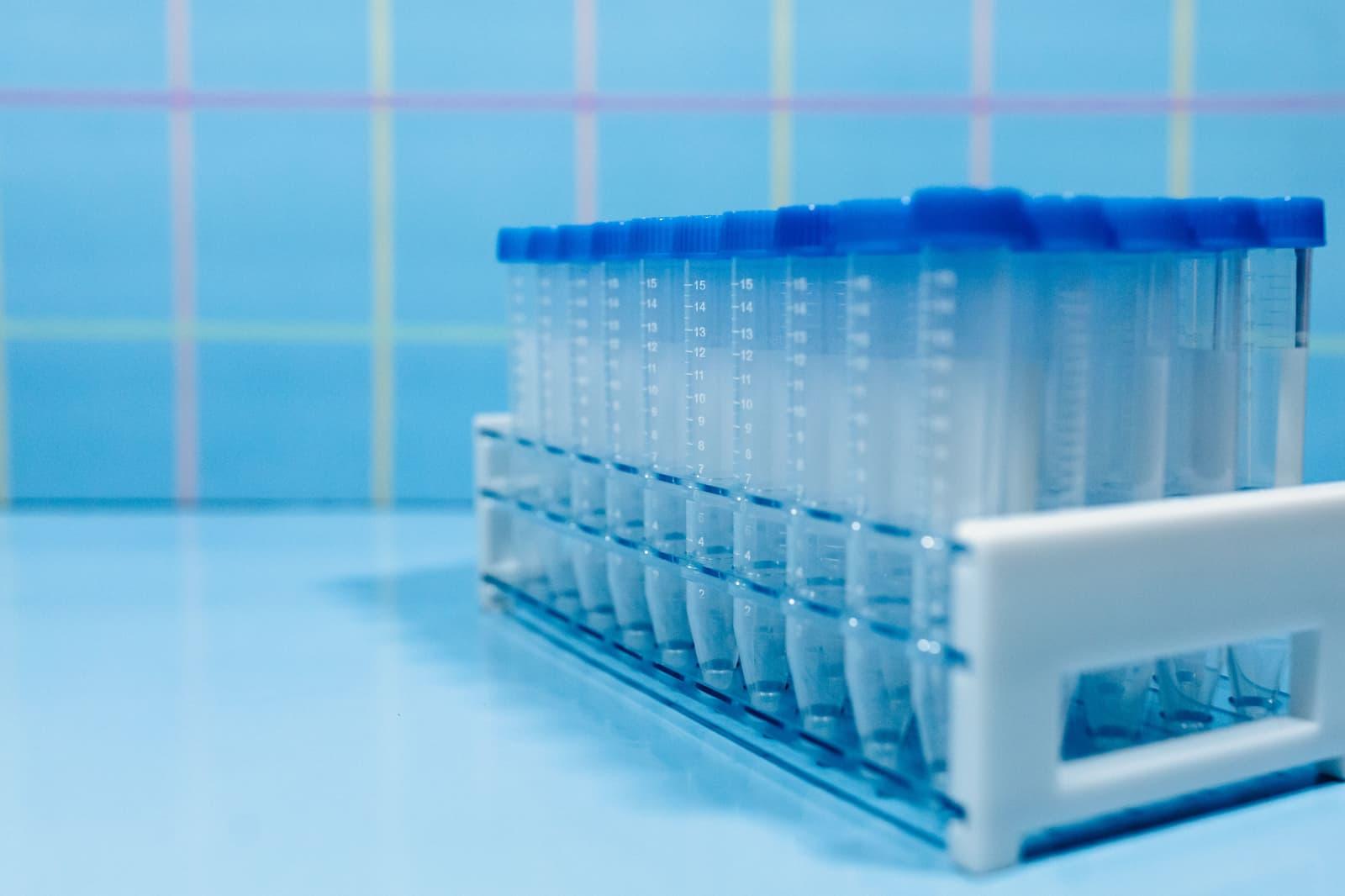 Empty test tubes with blue caps in a laboratory rack
